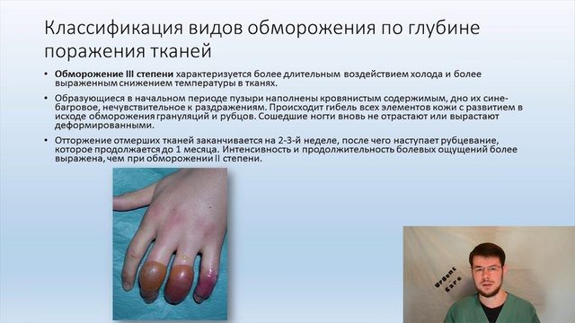 Первая помощь при обморожении смотреть онлайн