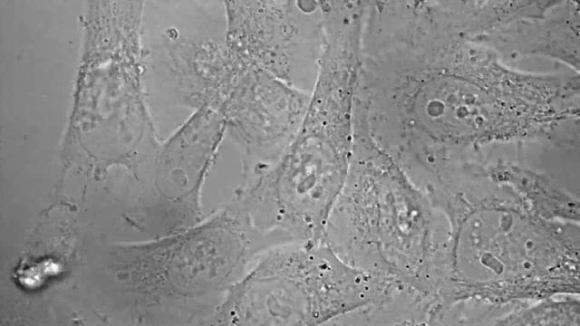 Бессмертные клетки HeLa под микроскопом смотреть онлайн