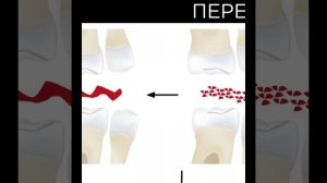 Физиология жевания и глотания за 1 минуту