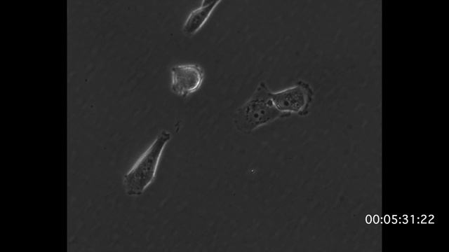 MDA-MB-231, Inonotus obliquus Treated Ruffeling смотреть онлайн