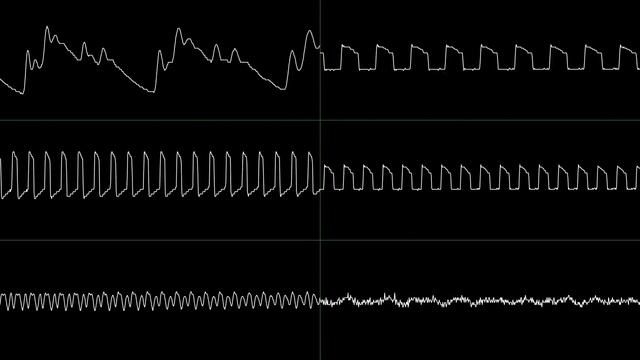 Dunehawk - Decader's Retro Collection (Oscilloscope View) [Vinyl 8-bit] смотреть онлайн