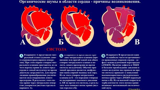Тема 16. Сердечные шумы. смотреть онлайн