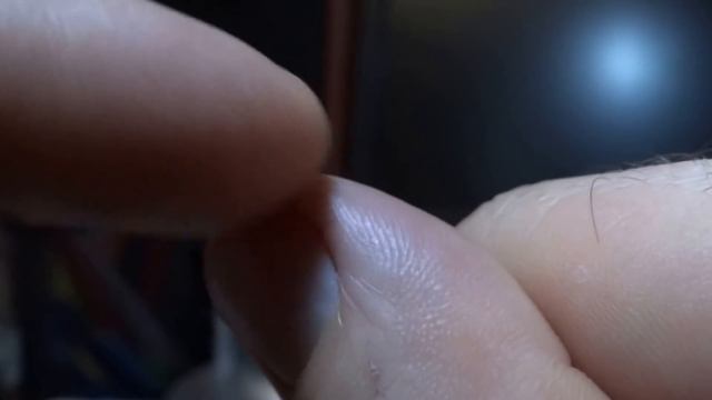 Трещины на пальцах рук. Как лечить правильно.