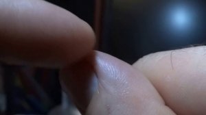 Трещины на пальцах рук. Как лечить правильно.