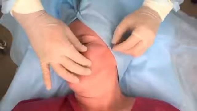 Формообразующая техника имплантации нитей Ex Visage смотреть онлайн