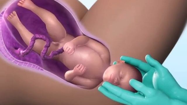 Роды смотреть онлайн