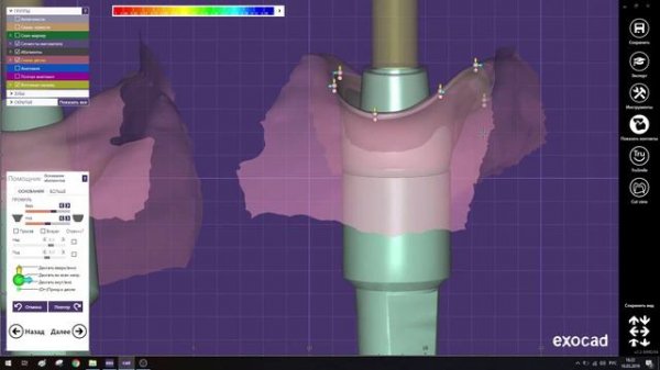 8. Абатмент Винтовая фиксация