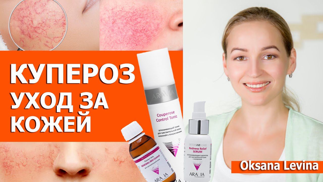 Как уменьшить КУПЕРОЗ. Уход за кожей при куперозе. Массаж и Пилинг при куперозе смотреть онлайн