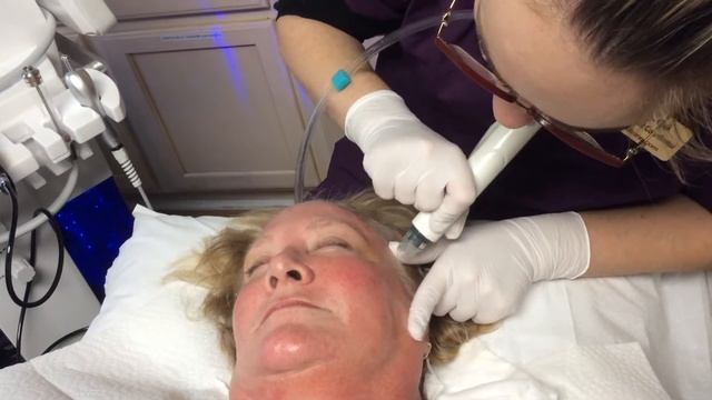 HydraFacial