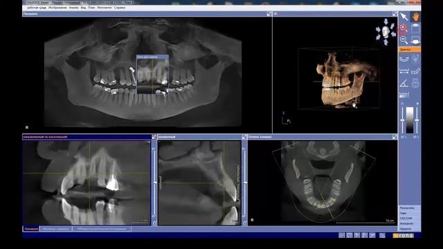 Обучение работе с программой Galaxis, Часть 1