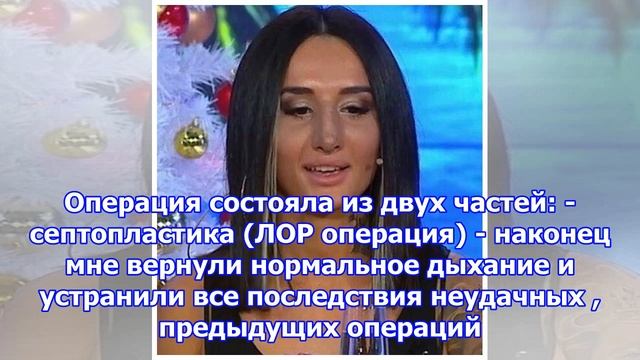 Марина мексика ужаснула результатом повторной ринопластики смотреть онлайн
