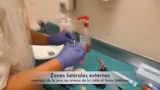 слепок нижний челюсть полный съемный протез смотреть онлайн