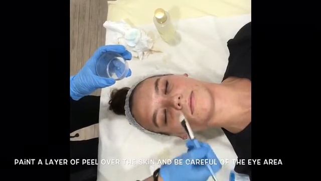 Toskani Combined Peel Demonstration