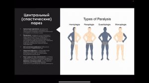 Неврология: пирамидный путь