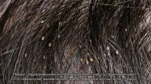 Могут ли завестись вши у человека на нервной почве, миф это или реальность