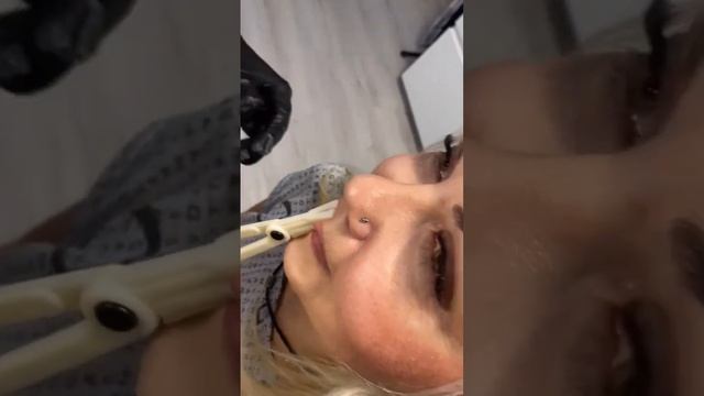 Прокол верхней губы - пирсинг для Танюши - готово #юмор #пирсинг смотреть онлайн