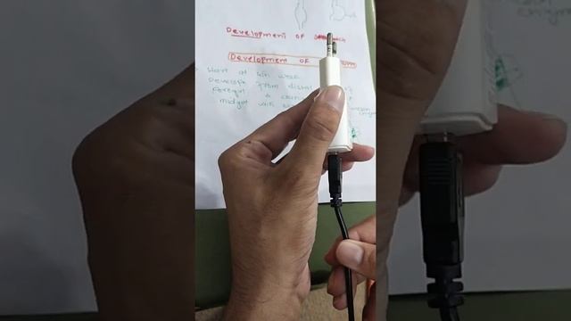 DEVELOPMENT AND ROTATION OF DUODENUM |GIT DEVELOPMENT PART2| #mbbs #embryology #Dr.Easy смотреть онлайн