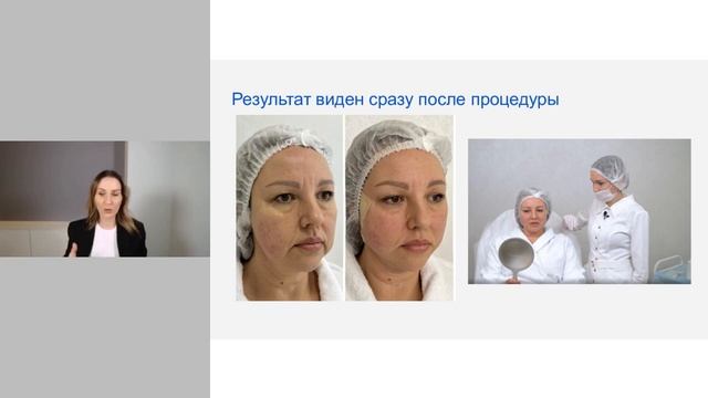 Как быстро и эффективно решать любые проблемы птоза смотреть онлайн