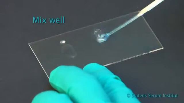 Видеоинструкция по проведению серотипирования сальмонеллы смотреть онлайн