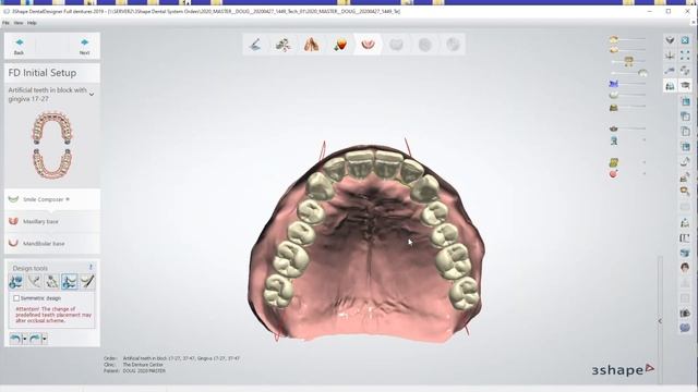 Design Digital Dentures with 3 Shape смотреть онлайн