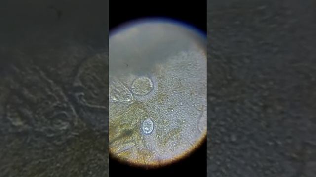 простейшие.Анализ кала смотреть онлайн