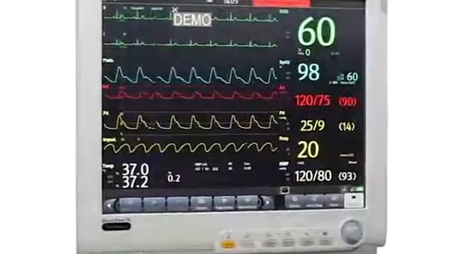 BeneView T8 обзор смотреть онлайн