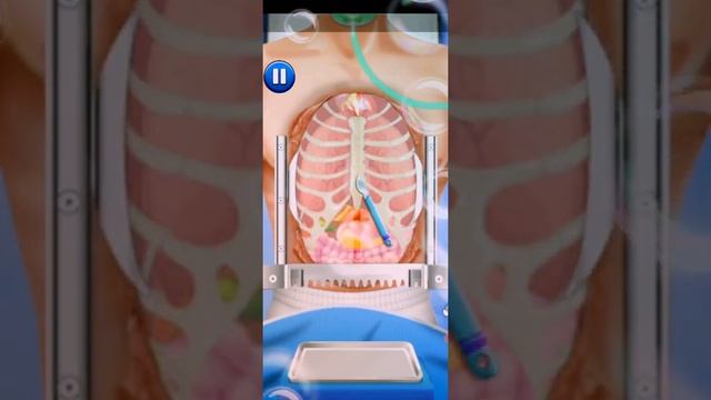 Open heart surgery game #Dra2 смотреть онлайн
