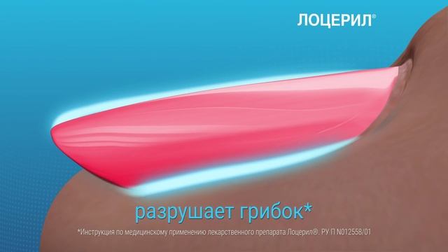 Лоцерил_Подарите свободу ногам! смотреть онлайн