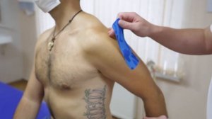 Тейпирование плеча (кинезиотейпирование плечевого сустава)