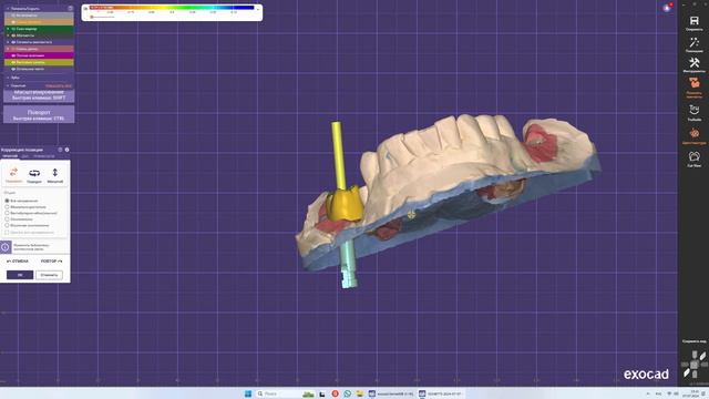 Коронка на Импланте ExoCad. Обучение для новичков. смотреть онлайн