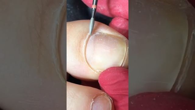 Шакирова Гульнара. Аппаратный педикюр. 2часть смотреть онлайн