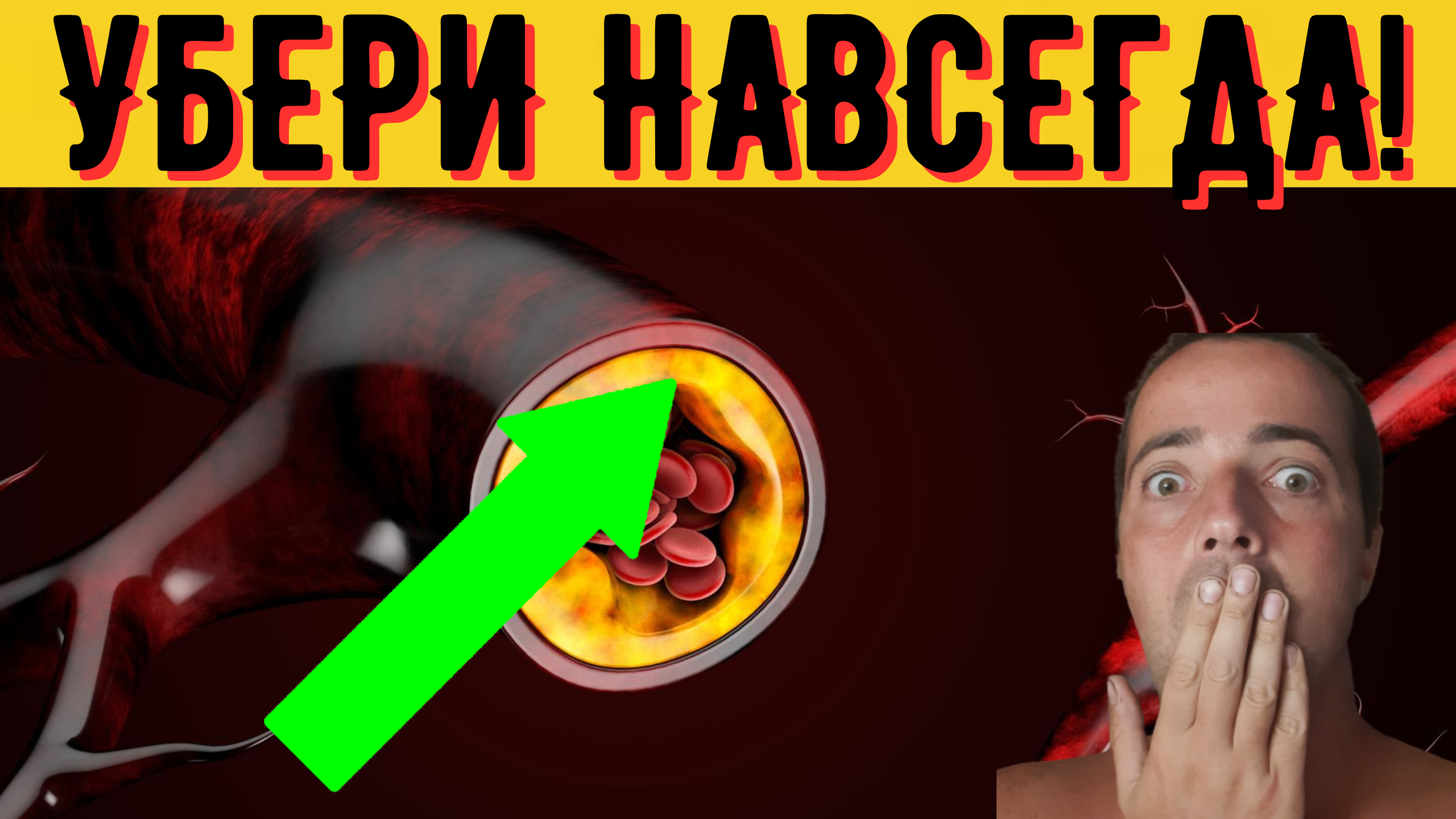 УБИРАЕМ ХОЛЕСТЕРИН БЕЗ ТАБЛЕТОК НАВСЕГДА! 100% ЭФФЕКТ!