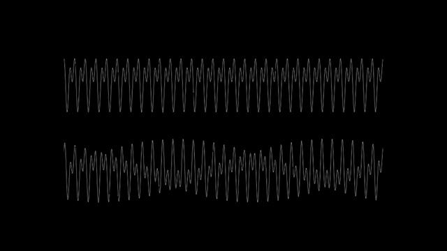Бинауральные ритмы и белый шум смотреть онлайн