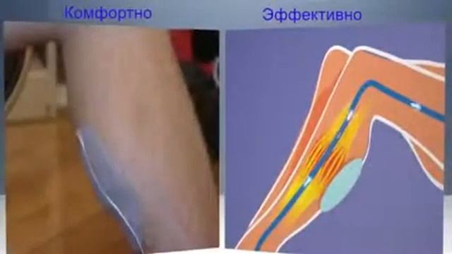 VeinoPlus НОВАЯ ТЕХНОЛОГИЯ смотреть онлайн