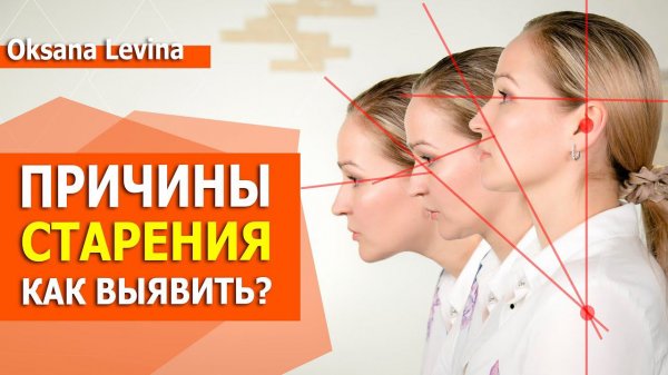 Потеря овала лица. Брыли, второй подбородок. Птоз. Диагностика старения.