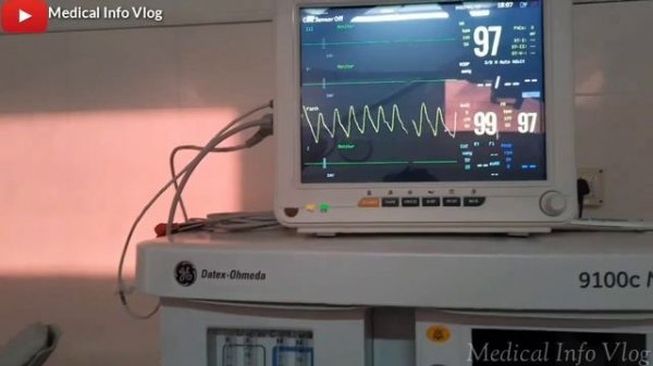 ICU/OT Patient monitor | Vital sign monitor | Hospital vlog | medical info vlog | explained monitor