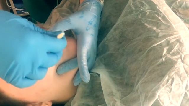 Шугаринг верхней губы смотреть онлайн