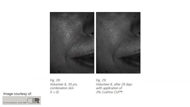 Pore reducing toner for mature skin смотреть онлайн