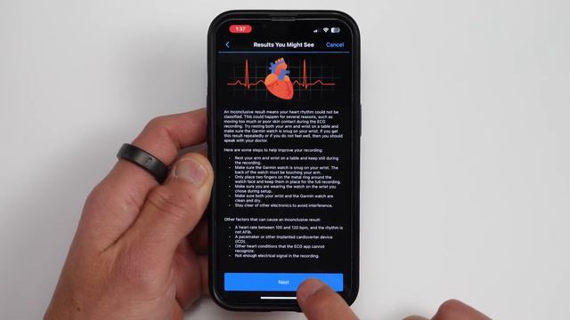 Garmin ECG For Epix Pro / Fenix 7 Pro / Venu 3 Is Here! How To Get It And How It Works