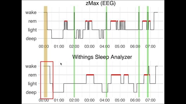 Withings Sleep Analyzer: Science Test (2021 Review) смотреть онлайн