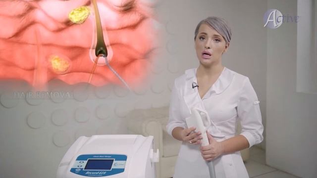 Фототермолиз, Что такое фототермолиз. Процедура фототермолиз. смотреть онлайн