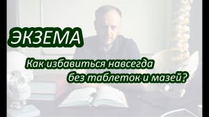 ЭКЗЕМА | лечение