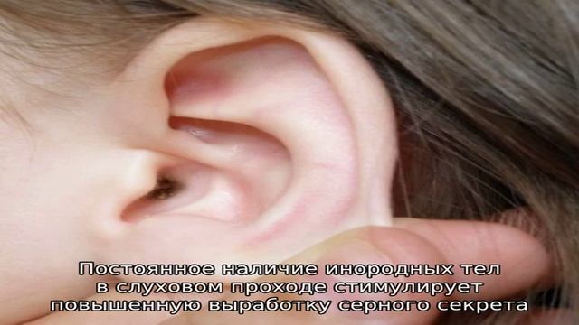 Почему в ушах образуется много серы смотреть онлайн