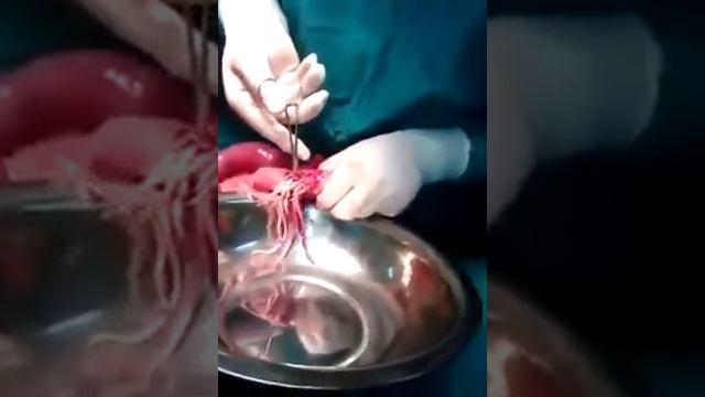 ПАРАЗИТЫ В КИШЕЧНИКЕ