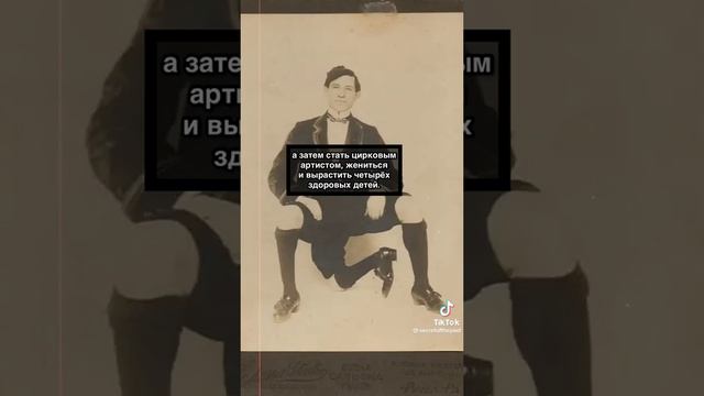 ФРАНЧЕСКО ЛЕНТИНИ – КОРОЛЬ «УРОДОВ» С 3 НОГАМИ, 16 ПАЛЬЦАМИ И 2 ПОЛОВЫМИ ОРГАНАМИ смотреть онлайн