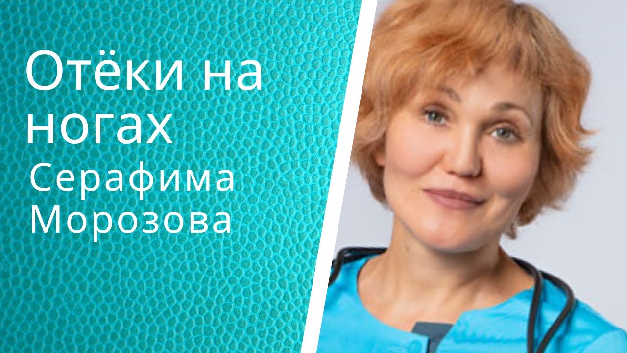 Упражнение для ног при отёках.mp4 смотреть онлайн