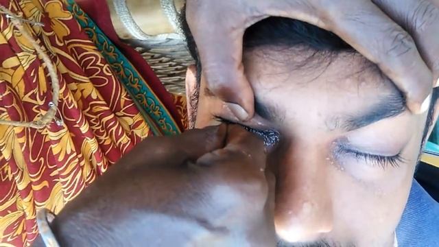 Eye cleaning смотреть онлайн