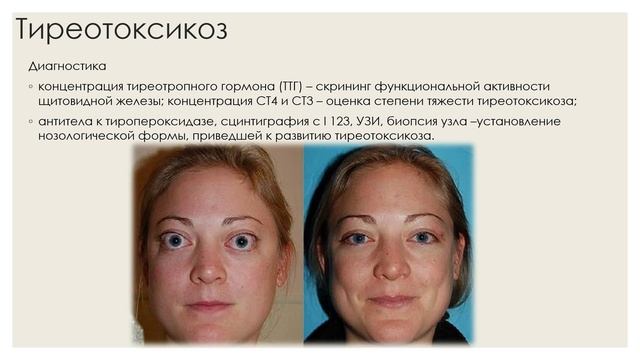 14. Прочие причины.mp4 смотреть онлайн