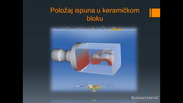 Cad Cam keramički ispun III смотреть онлайн
