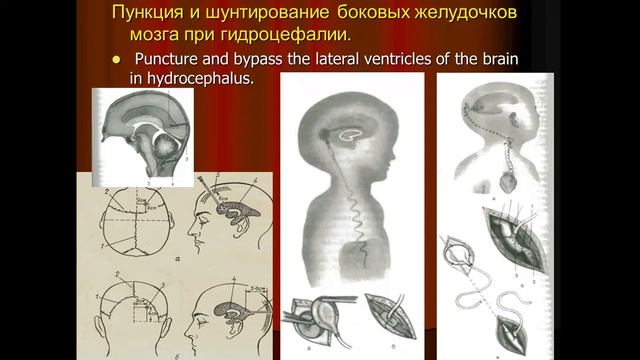 Лекция №4 Клиническая анатомия области головы смотреть онлайн